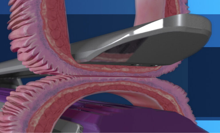 Covidien Tristaple Technology - Biologic Models
